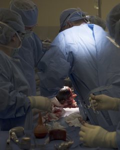 Dr. Peter Donner delivering a baby