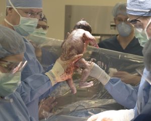 Dr. Peter Donner delivering a baby