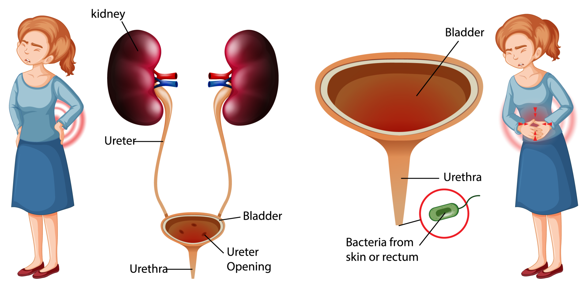 Anatomy of a UTI, including the kidney, ureter, urethra, and bladder